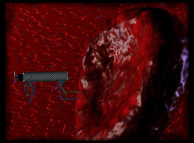 Artist rendition of a tiny robot approaching a malfunctioning red blood cell