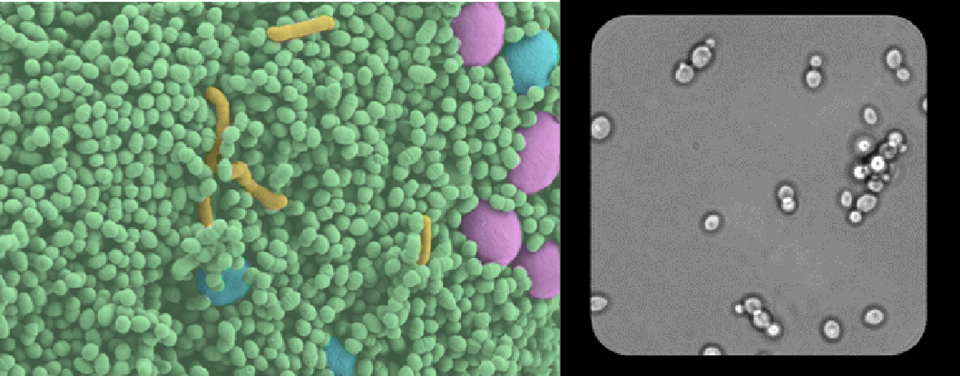 (LEFT) False-colored scanning electron micrograph of bacteria and yeast. (RIGHT) Time-lapse optical microscopy of W. anomolous in a single microwell.