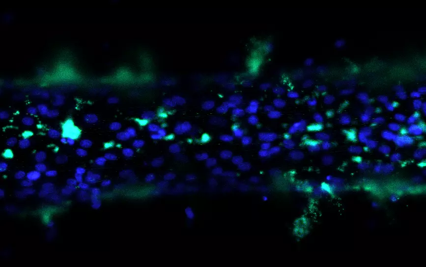 Colored micrograph shows blue and green blobs on black background.