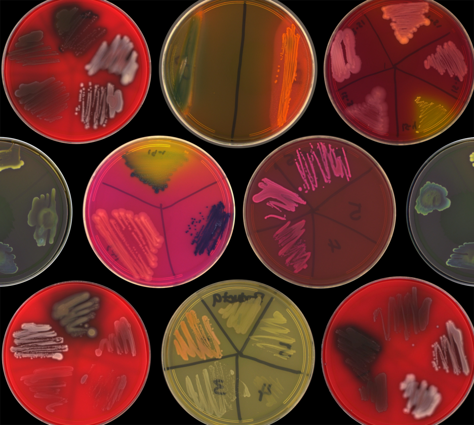 Microbial Strain