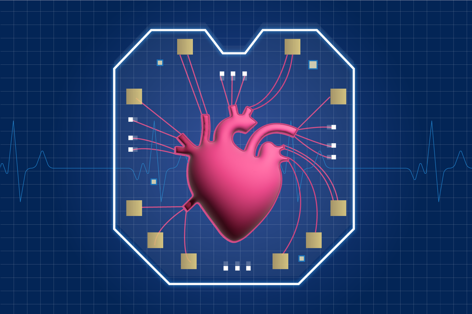 An illustrated anatomically correct human heart sits inside of a microchip, with its valves connecting to the microchip sensors.