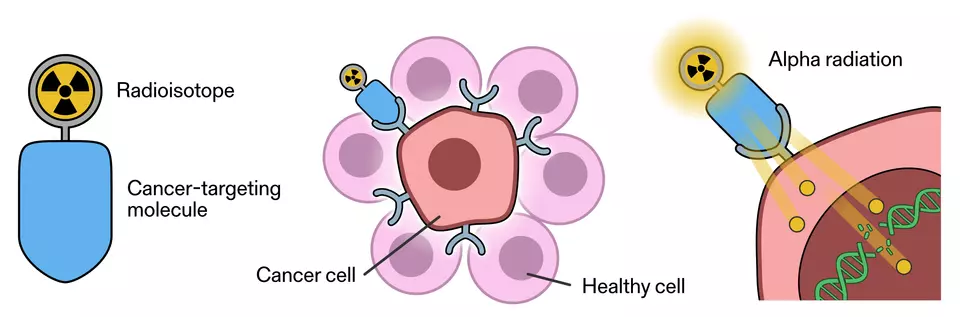Diagram shows a radioisotope attached to a cancer-targeting molecule and how the molecule attaches to a cancer cell and injects alpha radiation. 