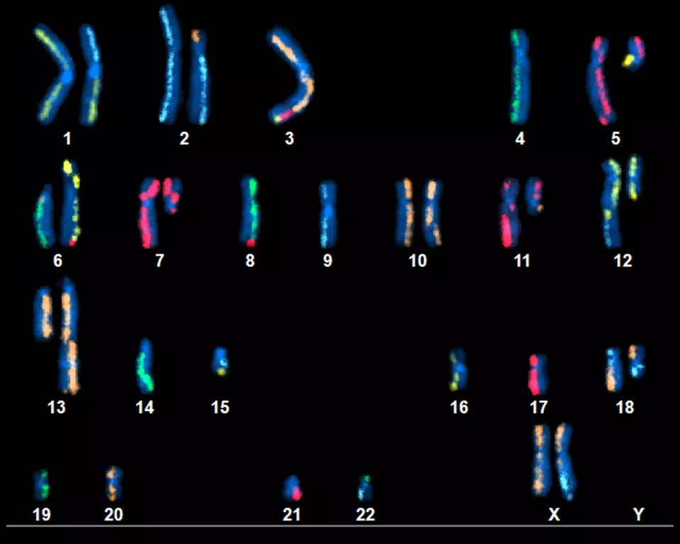 An image showing 22 pairs of numbered and color-coded chromosomes on a black background.