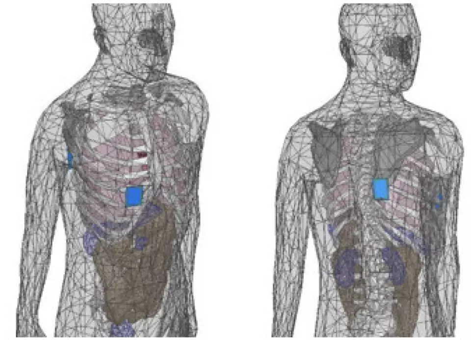 Model of computational human body and the antenna placements.
