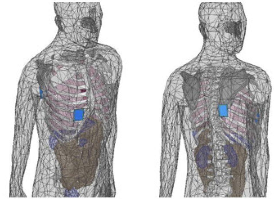 Model of computational human body and the antenna placements.