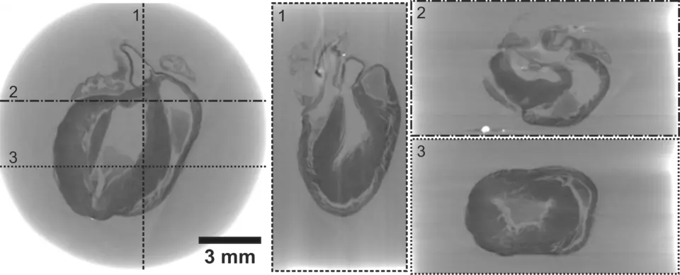 Images of mouse heart