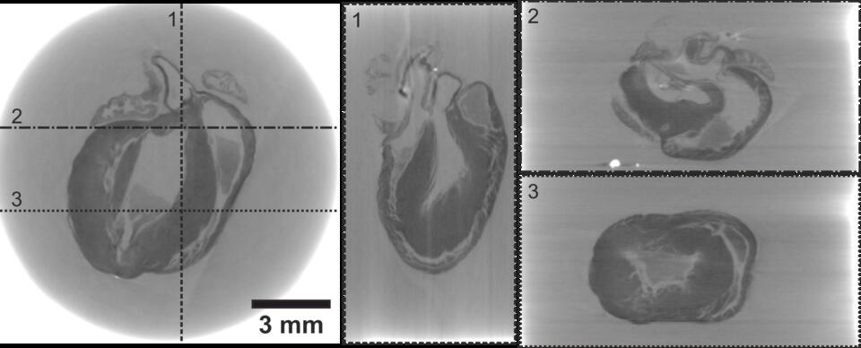 Images of mouse heart