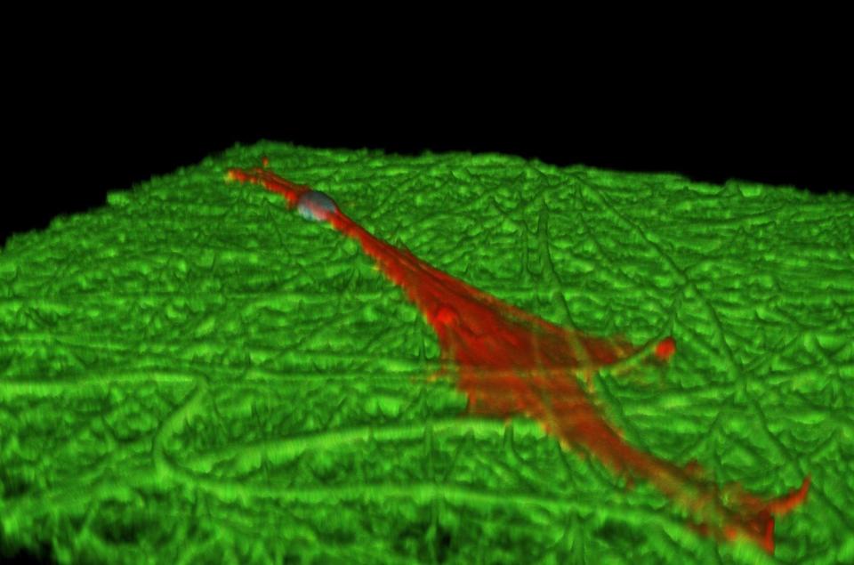 Primary human bone marrow stromal cell (hBMSC) cultured 1 d on a polymer fiber scaffold. Image captured by confocal fluorescence microscopy. Details in image caption.