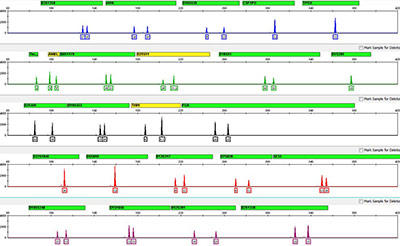 A DNA profile based on 24 genetic markers (stretches of DNA found at specific locations in the genome). 