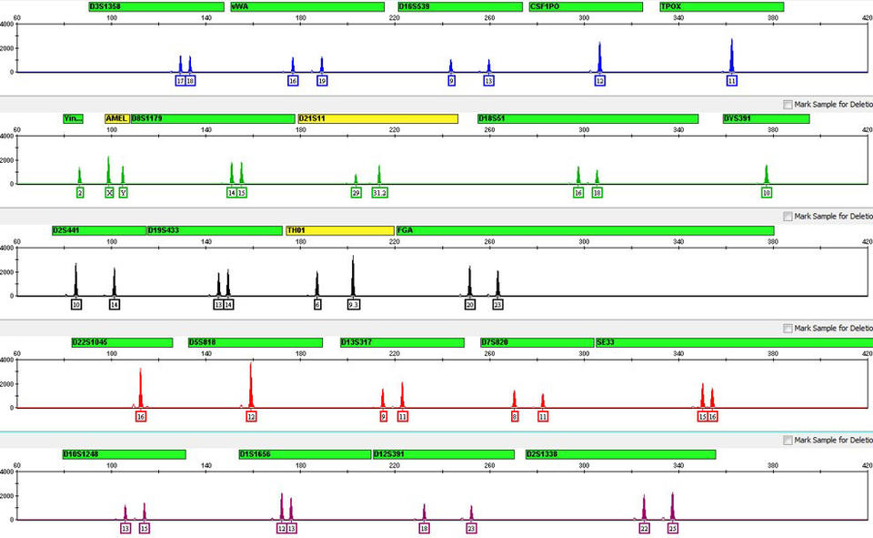 DNA Profile