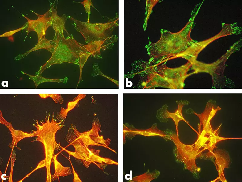 Microscopic images that look almost like spider webs