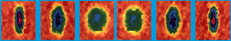 Bose-Einstein condensate