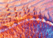 Micrograph shows fractures appearing at junction of enamel and dentin.