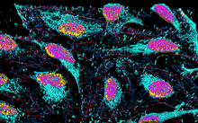 Colorized micrograph shows cells with pink centers and turquoise edges on a black background.