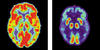 PET scans