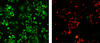 Photomicrographs demonstrate the dramatic impact of using nanotubes to selectively locate and destroy HER2 breast cancer tumors. 