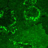 Deposits of hydroxyapatite crystal light up bright green where they've been tagged with a new peptide