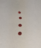 Photo of blood droplets